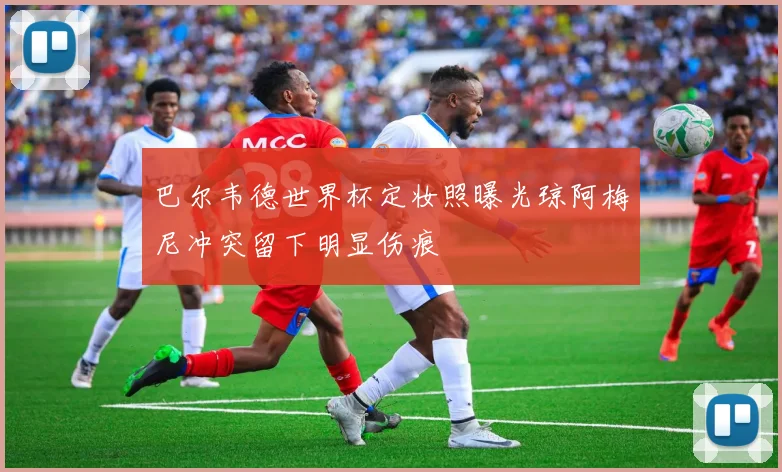 巴尔韦德世界杯定妆照曝光琼阿梅尼冲突留下明显伤痕